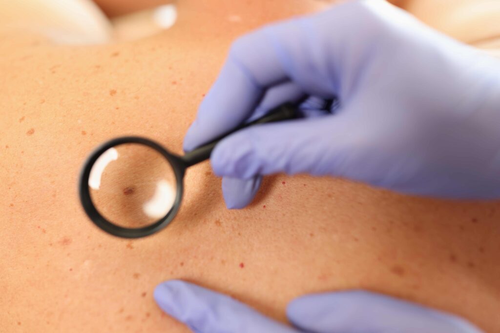 Médico dermatologista a examinar pele do paciente com dermatoscópio no Instituto Médico e Dentário Dra. Sara Martins