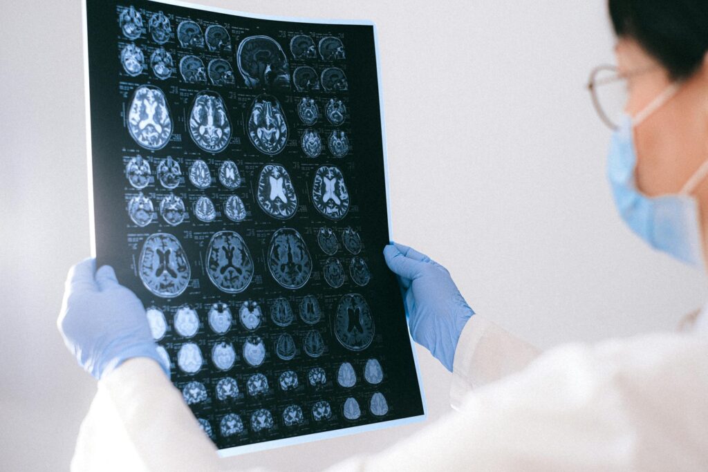 Exame neurológico e imagem cerebral em consulta de Neurologia